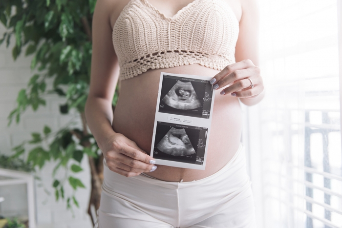 3D/4D Pregnancy Bonding Ultrasound Scan